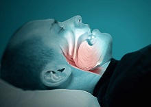 Sleep Apnea at Dream Sleep Center